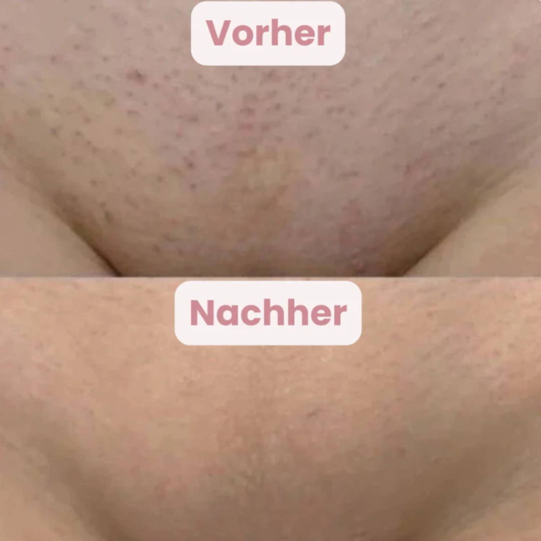 GlowTrim | Glatte Haut
