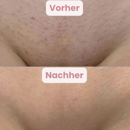 GlowTrim | Glatte Haut